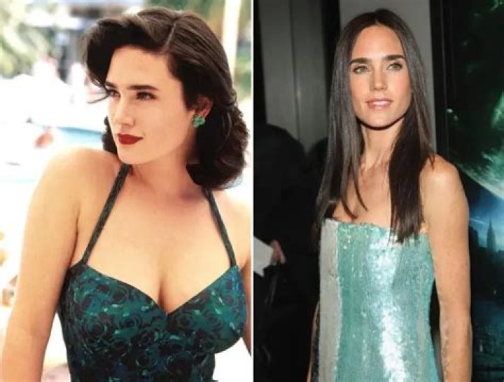 Jennifer Connelly Breast Reduction Plastic Surgery Before and After
